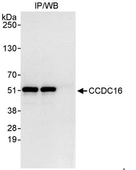 Rabbit anti-CCDC16 Antibody