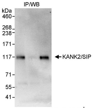 KANK2/SIP Antibody