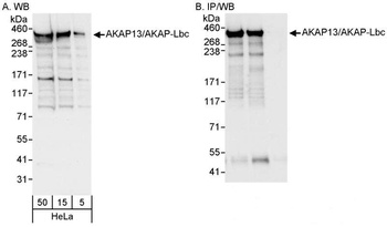 Rabbit anti-AKAP13/AKAP-Lbc Antibody