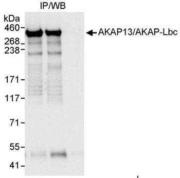 AKAP13/AKAP-Lbc Antibody