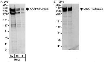 Rabbit anti-AKAP12/Gravin Antibody