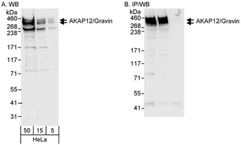 Rabbit anti-AKAP12/Gravin Antibody