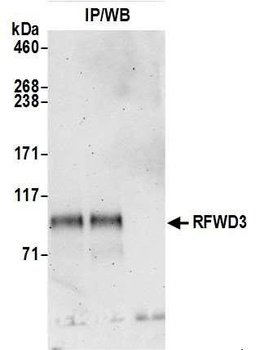 RFWD3 Antibody