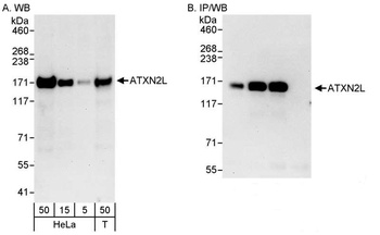 ATXN2L Antibody