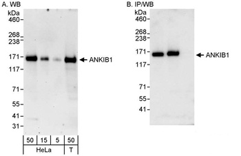 ANKIB1 Antibody