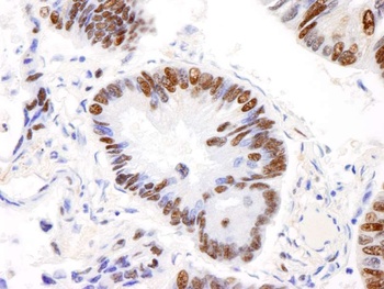 Rabbit anti-AKAP8L/HA95 Antibody
