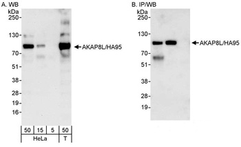 Rabbit anti-AKAP8L/HA95 Antibody