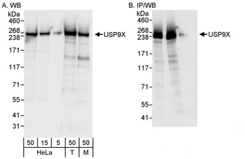 Rabbit anti-USP9X Antibody
