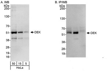 Rabbit anti-DEK Antibody