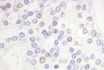 Rabbit anti-DEK Antibody