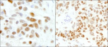 Rabbit anti-GTF2I/TFII-I Antibody