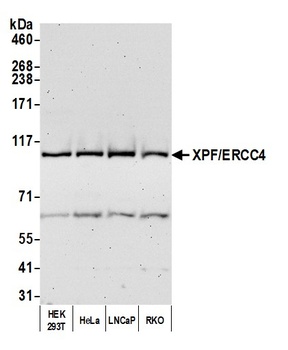 Rabbit anti-XPF/ERCC4 Antibody