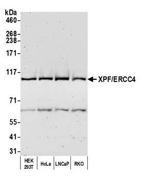 XPF/ERCC4 Antibody