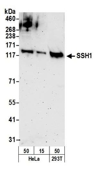 SSH1 Antibody