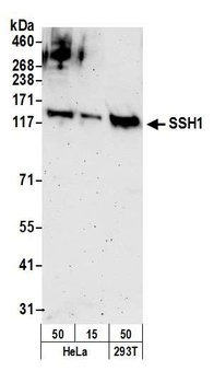 Rabbit anti-SSH1 Antibody