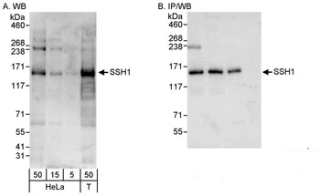 Rabbit anti-SSH1 Antibody