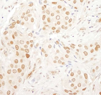 Rabbit anti-PAF49 Antibody