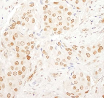 PAF49 Antibody