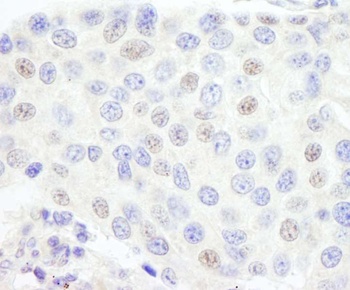 Rabbit anti-GTF3C1/TFIIIC220 Antibody