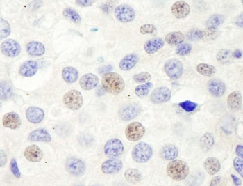 Rabbit anti-GTF3C1/TFIIIC220 Antibody