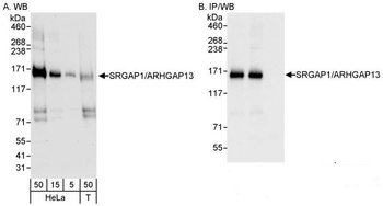 SRGAP1/ARHGAP13 Antibody
