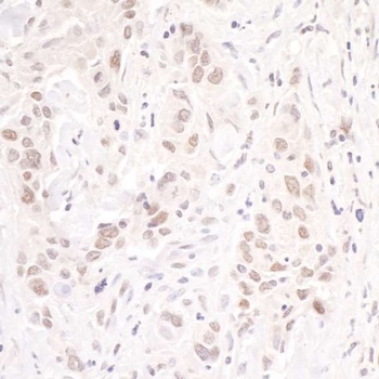 Rabbit anti-p66beta/GATAD2B Antibody