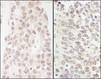 Rabbit anti-p66beta/GATAD2B Antibody