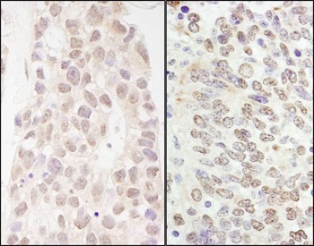 p66beta/GATAD2B Antibody