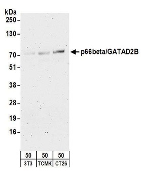 p66beta/GATAD2B Antibody