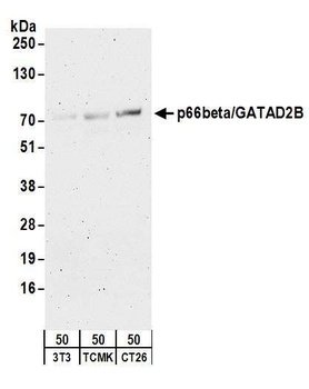 Rabbit anti-p66beta/GATAD2B Antibody