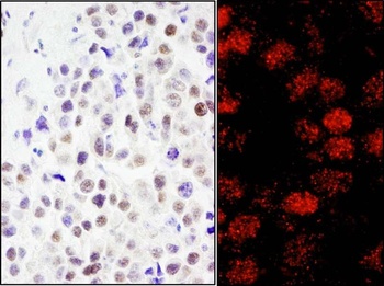 Rabbit anti-RCOR3 Antibody
