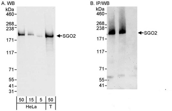 Rabbit anti-SGO2 Antibody