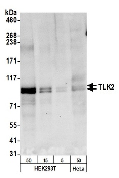 Rabbit anti-TLK2 Antibody