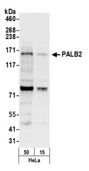 Rabbit anti-PALB2 Antibody