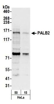 PALB2 Antibody