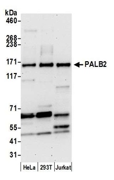Rabbit anti-PALB2 Antibody