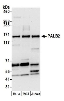 PALB2 Antibody