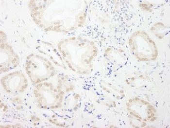 Rabbit anti-GTF3C4/TFIIIC90 Antibody