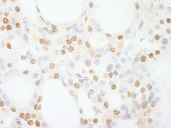 Rabbit anti-GTF3C4/TFIIIC90 Antibody
