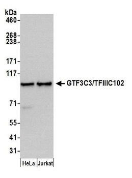 GTF3C3/TFIIIC102 Antibody