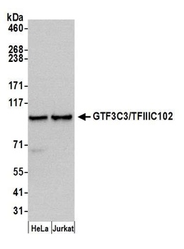 Rabbit anti-GTF3C3/TFIIIC102 Antibody