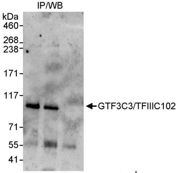 Rabbit anti-GTF3C3/TFIIIC102 Antibody