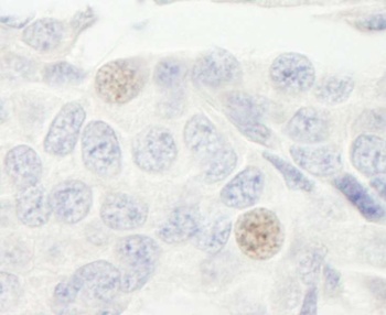 Rabbit anti-GTF3C2/TFIIIC110 Antibody