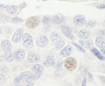 GTF3C2/TFIIIC110 Antibody