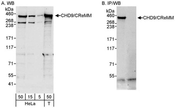 Rabbit anti-CHD9/CReMM Antibody