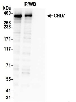 CHD7 Antibody