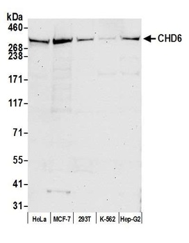 Rabbit anti-CHD6 Antibody