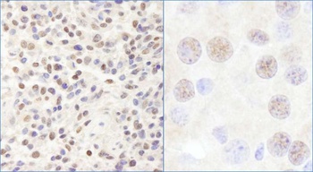 Rabbit anti-CHD3 Antibody