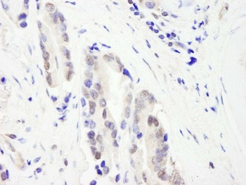 Rabbit anti-CHD3 Antibody
