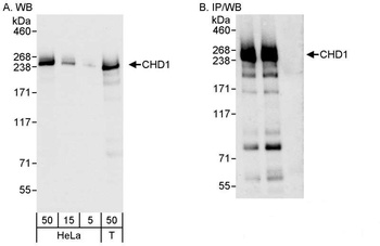 Rabbit anti-CHD1 Antibody